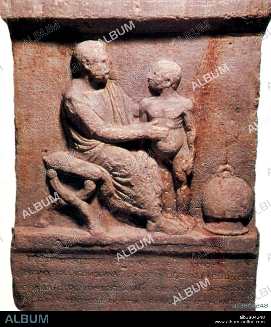 A stele of the physician Jason of Athens with the text: "Jason, also known as Decimus, of the Archarnian deme", Jason examines a child, with an unnaturally enlarged stomach. To the right a cupping vessel is shown (scale exaggerated) which when heated is used to draw blood or pus from a wound. Cupping, an ancient therapy was used until the 19th century assumed to restore the balance of the body's humours. The vessel when heated created a partial vacuum that made it stick to the body surface by suction. This raised a weal on the skin (dry cupping) or drew out blood (wet cupping) if it was set over cuts.