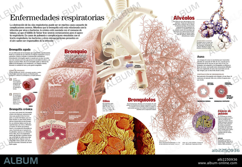 enfermedades respiratorias. Infografía de las principales enfermedades respiratorias como la bronquitis, el asma y el cáncer de pulmón.