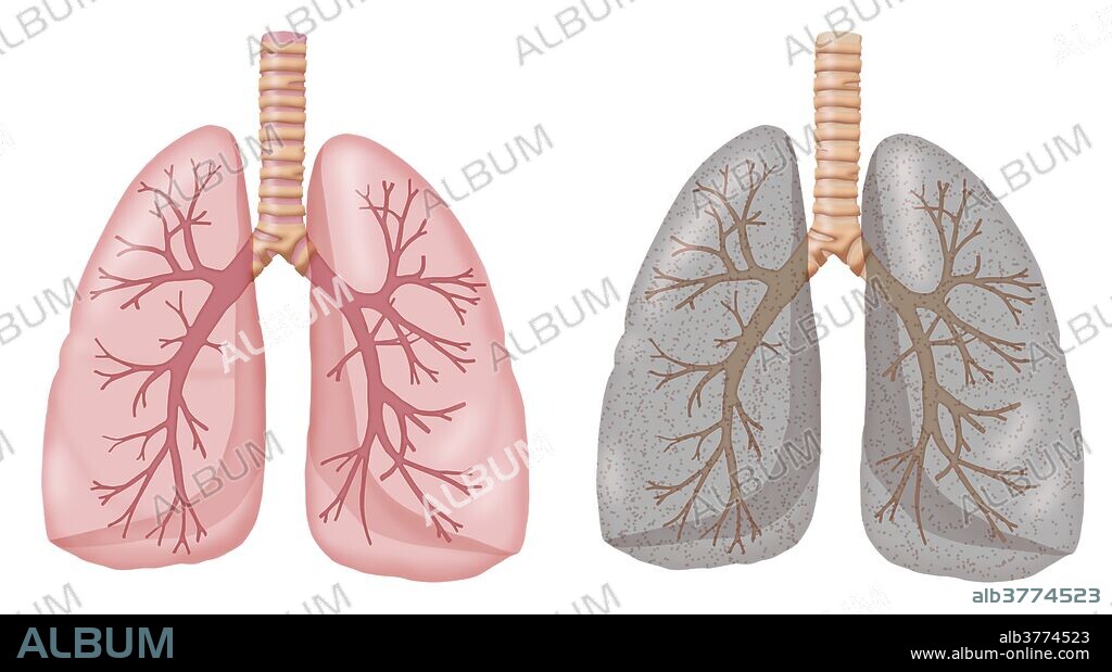 Illustration comparing the lungs of a non-smoker (left) and a smoker (right). The non-smoker's lungs are pink and healthy, whereas the smoker's are gray and filled with harmful particles.