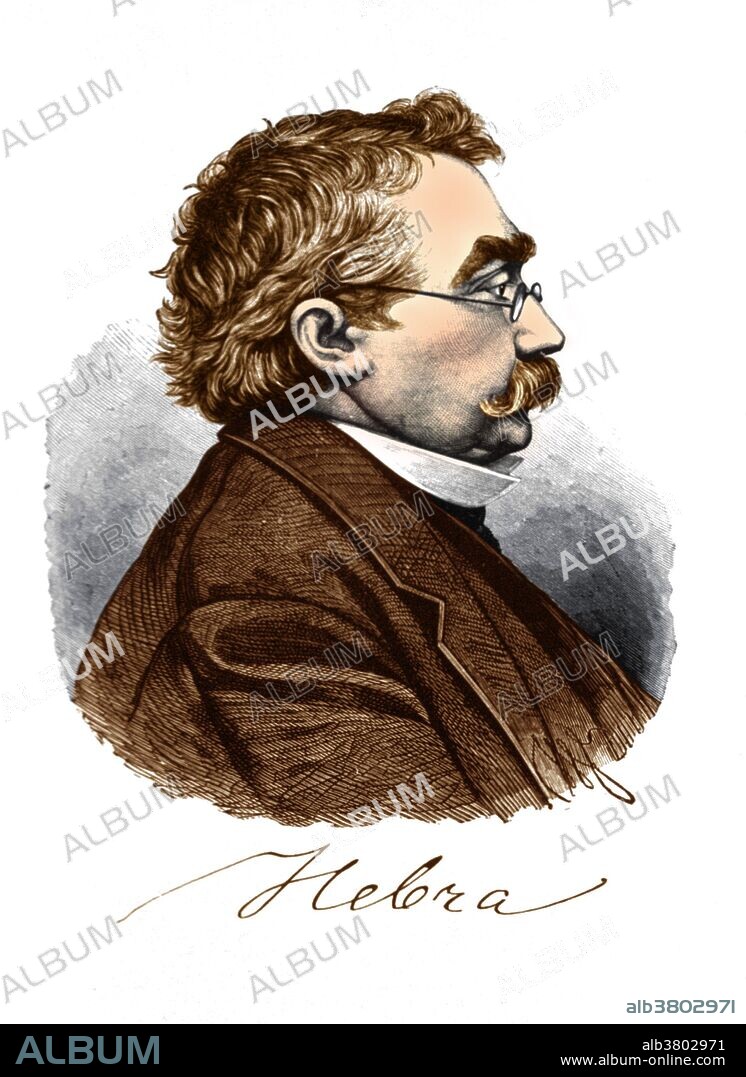 Ferdinand Ritter von Hebra (1816-1890) was an Austrian physician and dermatologist, and founder of the New Vienna School of Dermatology, an important group of physicians who set the basis for modern dermatology.