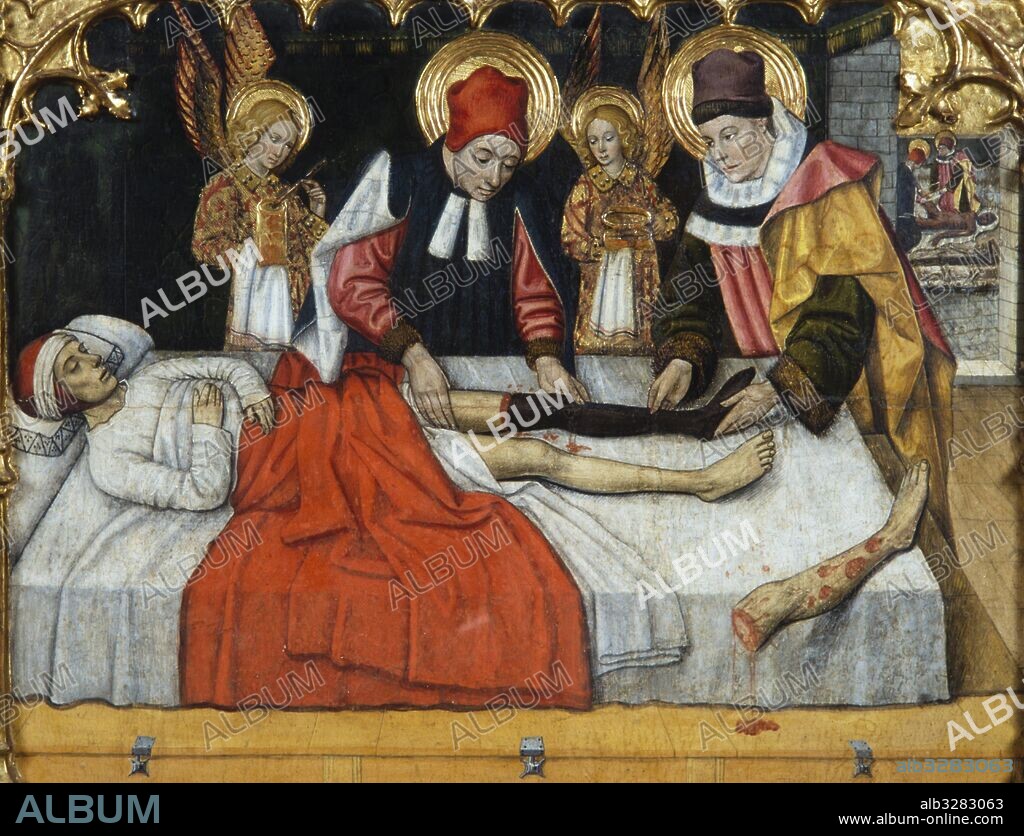 JAUME HUGUET. Predella of the altarpiece of the saints Abdón and Senén, 1460. Miracle of the gangrenous leg, San Cosme and San Damián. Tempera painting of egg on board. 301x225 cm. Church of Santa María, Terrasa.
