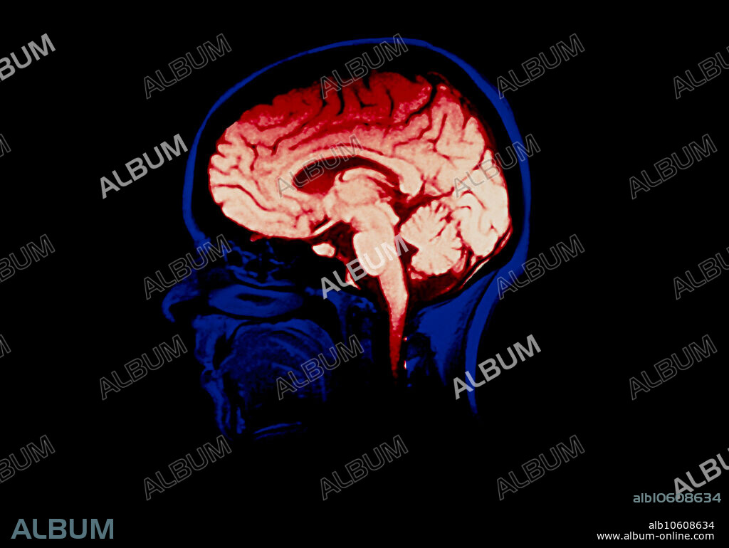 Brain scan. Coloured Magnetic Resonance Imaging (MRI) scan through a human head, showing a healthy brain in side view. The face is seen in profile at left (blue). Tissues of the mouth, nasal cavity, and central nervous system (pink) are visible. The folded cerebrum of the brain (at top) makes up the larger part of the brain; intelligent thought processes, memory and conscious movement are processed in the cerebrum. At centre is the elongated brainstem which controls involuntary reflexes like breathing and eye reflexes; it connects with the spinal cord. To the right of the brainstem is the cerebellum which is involved in body posture, balance & coordination of movement.