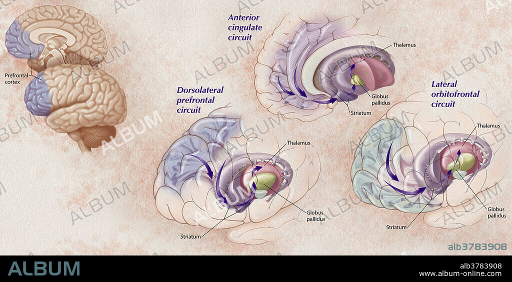 This illustration shows three circuits of the prefrontal cortex of the brain, the anterior cingulate circuit, the dorsolateral prefrontal circuit, and the Lateral orbitofrontal circuit. Also show are the pathways to the thalamus through the striatum and globus pallidus. the dorsolateral prefrontal cortex and anterior cingulate cortex are critical for mood regulation. The orbitofrontal circuit is involved in the reward system via the dopaminergic system to drive and shape behaviour. All three circuits are involved in depression, mania and obsessive compulsive disorders when involved with injury or lesion to the frontal lobe of the brain.
