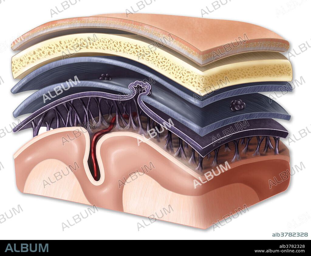 An illustration of the membranes that enclose the brain and spinal cord. The meninges include the periosteal and meningeal dura mater, the arachnoid mater and the pia mater. Arachnoid granulations protrude into the superior sagittal sinus while arachnoid trabeculae attach the arachnoid mater to the pia mater.