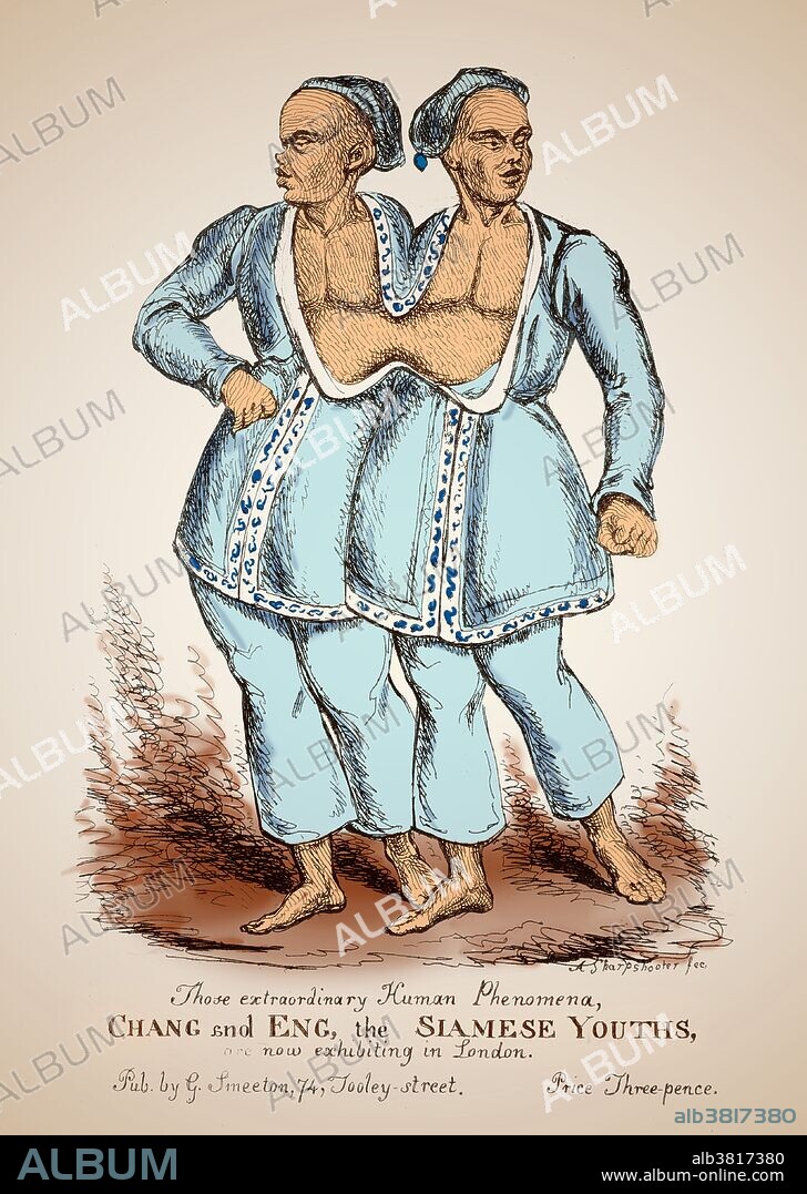 Chang and Eng (May 11, 1811 - January 17, 1874) were conjoined twin brothers whose condition and birthplace (Siam, now Thailand) became the basis for the term "Siamese twins". The brothers were joined at the sternum by a small piece of cartilage. Their livers were fused but independently complete. In 1829, they were "discovered" in Siam by British merchant Robert Hunter toured the world as a curiosity. Upon termination of their contract they were determined to start living a normal life as much as possible. They became naturalized United States citizens, settled on a plantation in North Carolina, bought slaves and adopted the last name "Bunker". The twins died on the same day in January 1874. Chang, who had contracted pneumonia, died rather suddenly in his sleep. Eng awoke to find his brother dead, and called for his wife and children to attend to him. A doctor was summoned to perform an emergency separation, but Eng refused to be separated from his dead brother. He died three hours later.