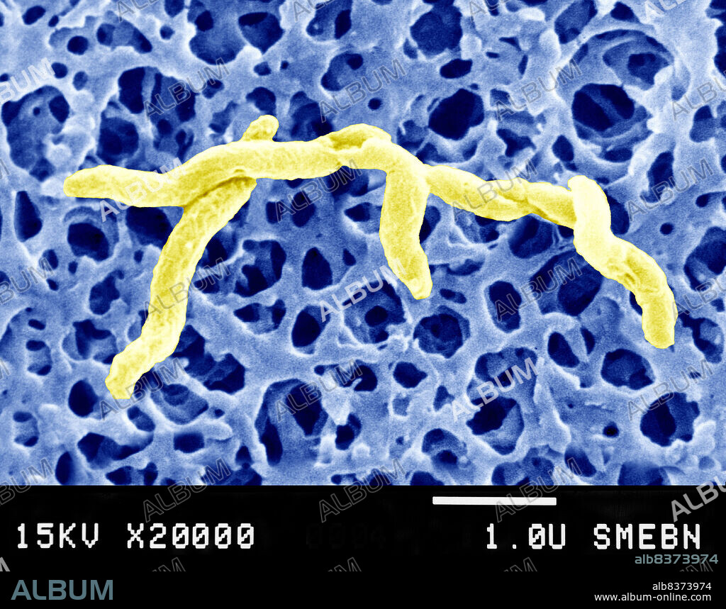 Campylobacter is a family of curved Gram-negative bacteria. Several species have been identified. Campylobacter pylori (the causal agent of gastritis, ulcers, etc.), Campylobacter fetus, and Campylobacter jejuni. Scanning electron microscopy of Campylobacter jejuni. SEM 20000x.