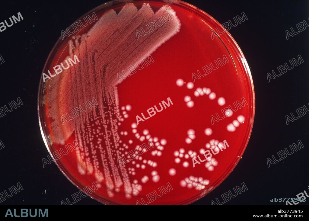 Colony of E. coli (Escherichia coli) on blood agar. E. coli is a normal bacterial inhabitant of the human intestine. Under certain conditions, the e. coli bacteria may become harmful and cause infection in the intestinal or urinogenital tracts.