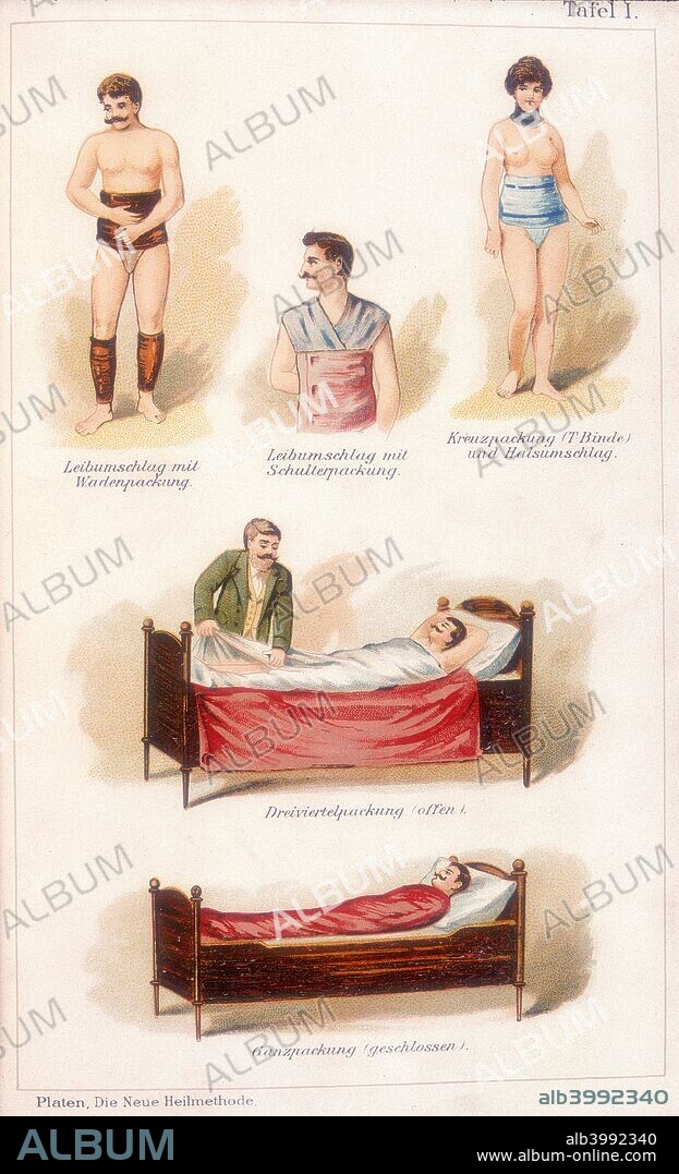 Hydrotherapy treatments, c1902. Wet packs for the treatment of the whole body and for specific areas. One of the oldest forms of medical treatment, hydrotherapy enjoyed a resurgence in popularity in the late 19th century. From Die Neue Heilmethode Lehrbuch by M Platen. (Berlin, c1902).
