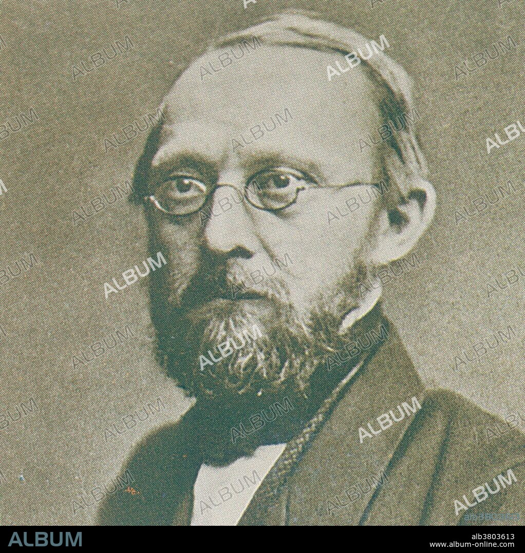 Rudolph Carl Virchow (October 13, 1821 - September 5, 1902) was a German doctor, anthropologist, pathologist, prehistorian, biologist and politician, public health advocate. Referred to as "the father of modern pathology," he is considered one of the founders of social medicine. His most widely known scientific contribution is his cell theory, which built on the work of Theodor Schwann. He is cited as the first to recognize leukemia cells. Another significant credit relates to the discovery, made simultaneously by Virchow and Charles Troisier, that an enlarged left supra-clavicular node is one of the earliest signs of gastrointestinal malignancy. He described the factors contributing to venous thrombosis and coined the term embolism. He founded the medical fields of cellular pathology and comparative pathology. In response to a lack of standardization of autopsy procedures, he established and published specific autopsy protocols. Virchow was an advocate for social and political reform stating, "The physicians are the natural attorneys of the poor, and social problems fall to a large extent within their jurisdiction." He died of heart failure in 1902 at the age of 80.