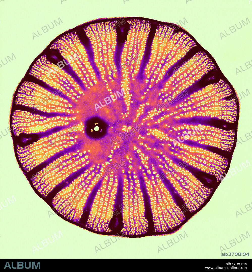 Diatom, Cyclotella Meneghiniana Kutzing, TEM