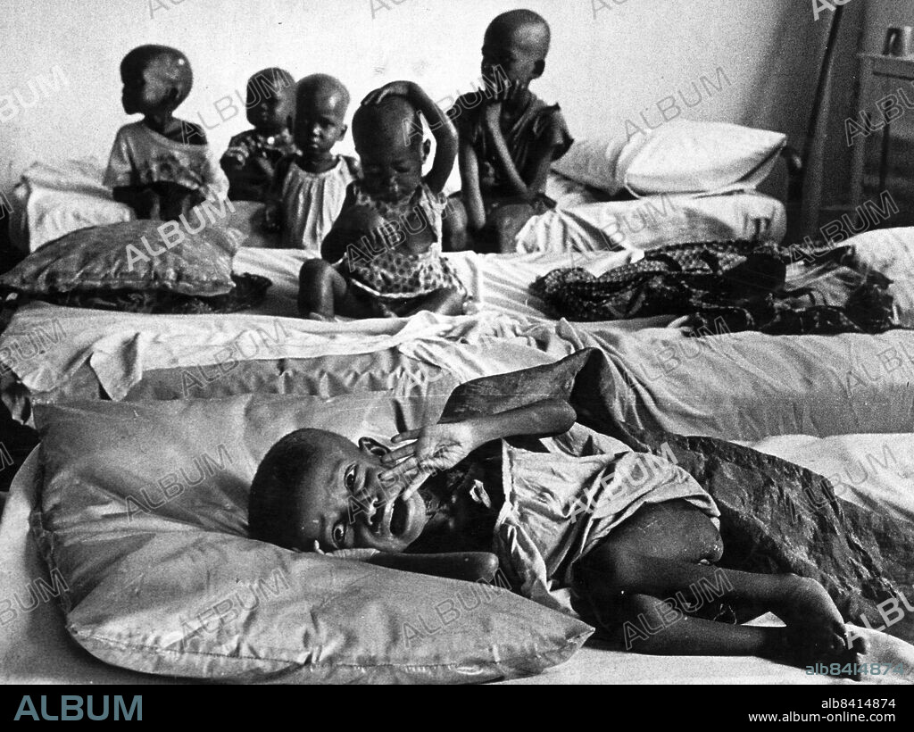 Biafra 1969-03-15. Hungersnöd i Biafra i samband med Biafrakriget. Undernärda barn. Foto: Sven-Erik Sjöberg / DN / TT / Kod: 53. ** SvD OUT **.