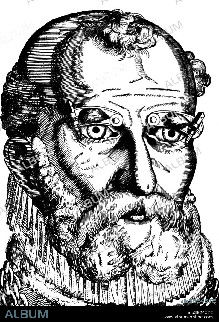 Woodcut entitled: Use of the clamp in eyelid surgery. Close-up of a man's face showing eyelid clamps for the treatment of ptosis. Ptosis is a drooping or falling of the upper or lower eyelid. The drooping may be worse after being awake longer, when the individual's muscles are tired. If severe enough and left untreated, the drooping eyelid can cause other conditions, such as amblyopia or astigmatism. Ptosis occurs when the muscles that raise the eyelid (levator and MÃ¼ller's muscles) are not strong enough to do so properly. It can affect one eye or both eyes and is more common in the elderly, as muscles in the eyelids may begin to deteriorate. Ptosis can also be congenital. Appeared in Ophthalmodouleia by Georg Bartisch, 1583.