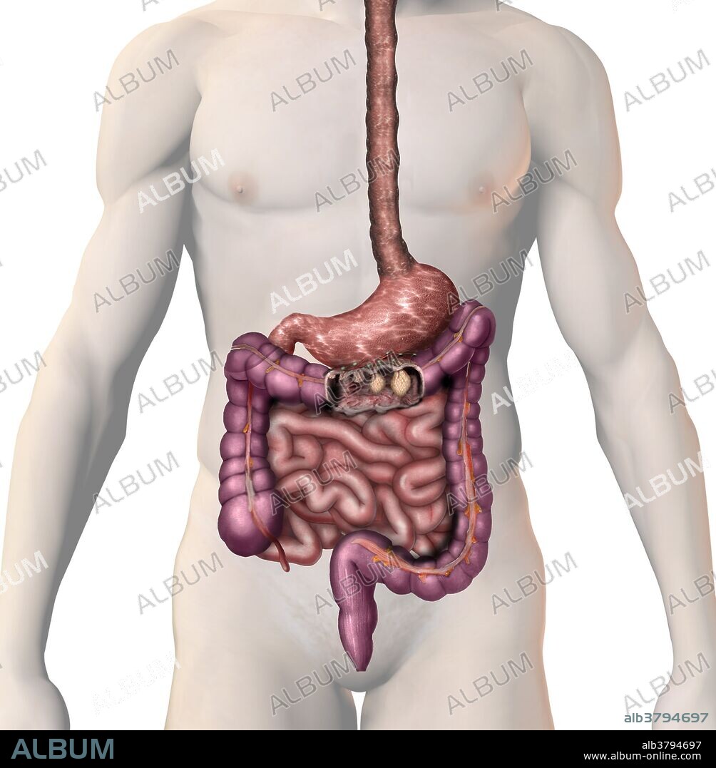 Colon Cancer, illustration