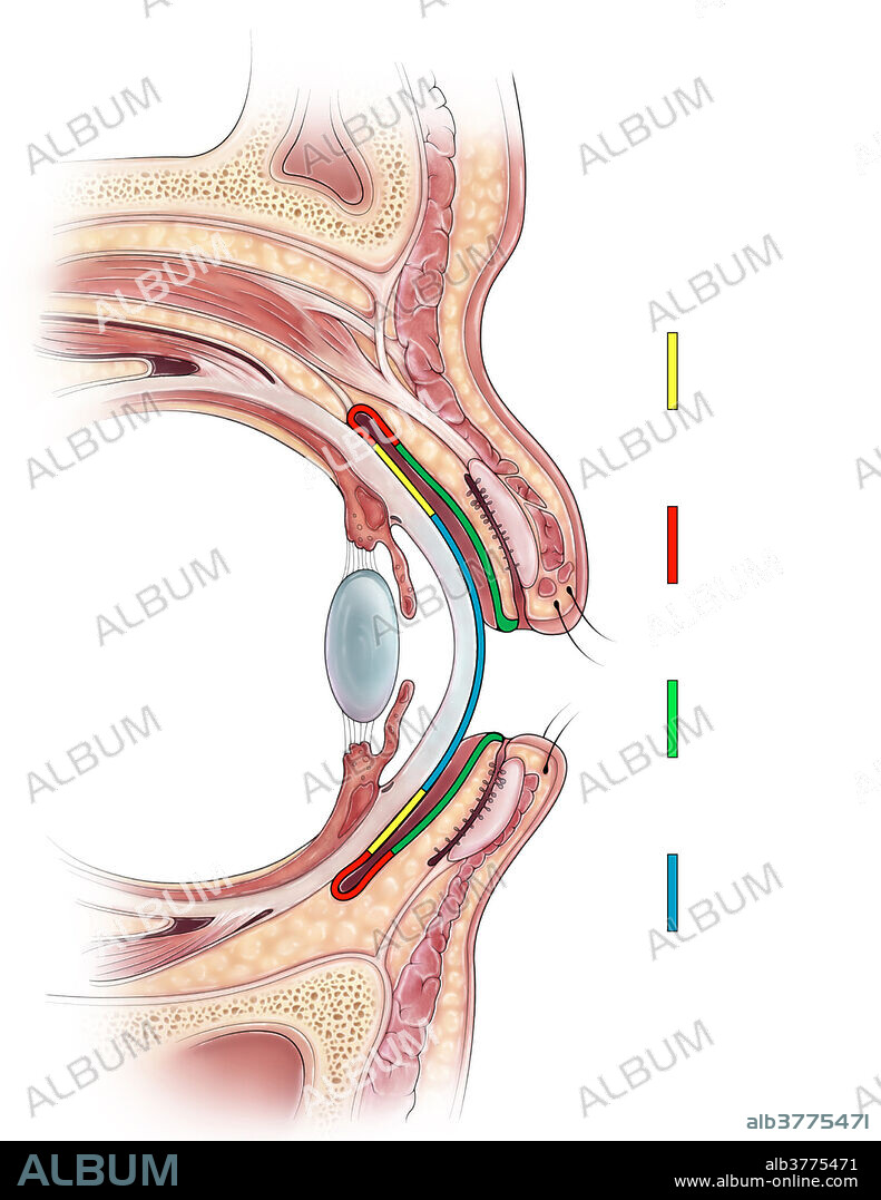 Conjunctiva Illustration