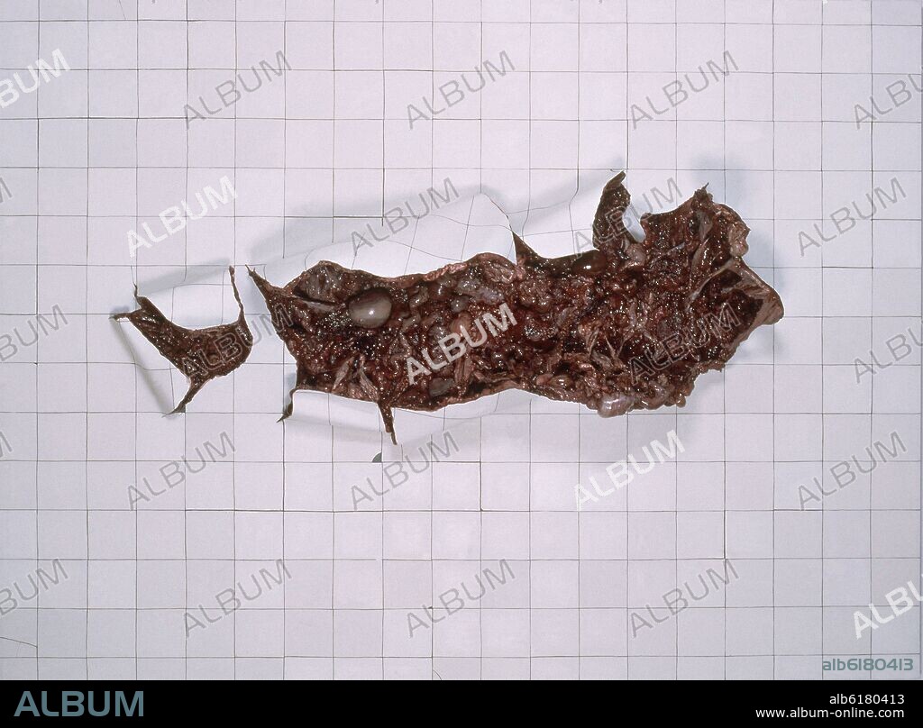 ADRIANA VAREJAO (1964-). AZULEJERIA BRANCA EN CARNE VIVA-2002-Oleo sobre tela y poliuretano sobre aluminio y madera 270x200x4.