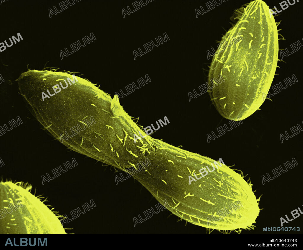 Scanning Electron Micrograph (SEM) of Tetrahymena, a ciliate protozoa common in freshwater. The central protozoa in this micrograph is going through mitosis. Magnification: 6,000X at 8 x 10 print size. This image has been colour-enhanced.