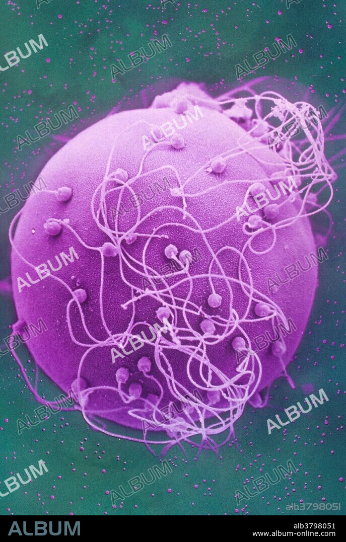 Color enhanced scanning electron micrograph (SEM) of sperm surrounding a human egg. Magnification: 480x at 35mm.