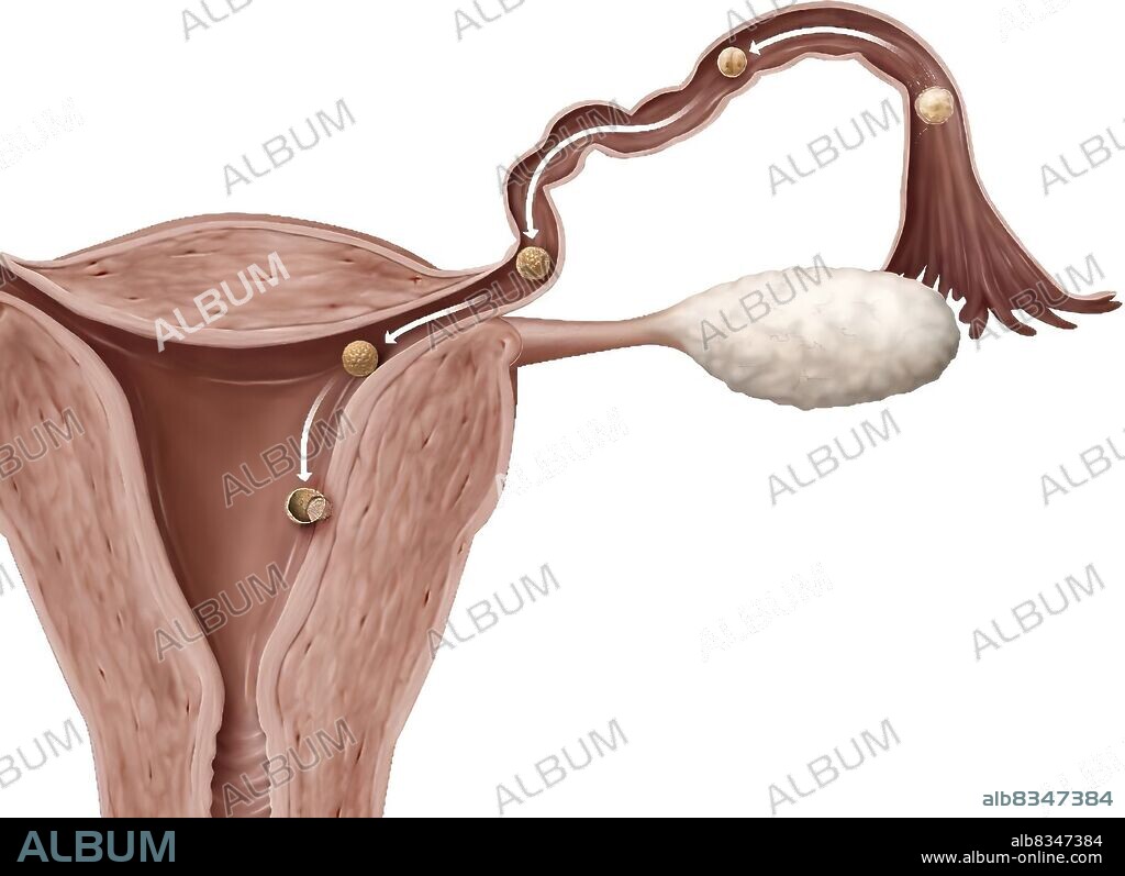 Nidation is the implantation of a fertilized egg in the endometrium, six or seven days after fertilization. The cells of its outer layer (trophoblast) multiply and erode the endometrium, which enables the blastocyst to anchor itself there. The implantation phase lasts approximately one week.