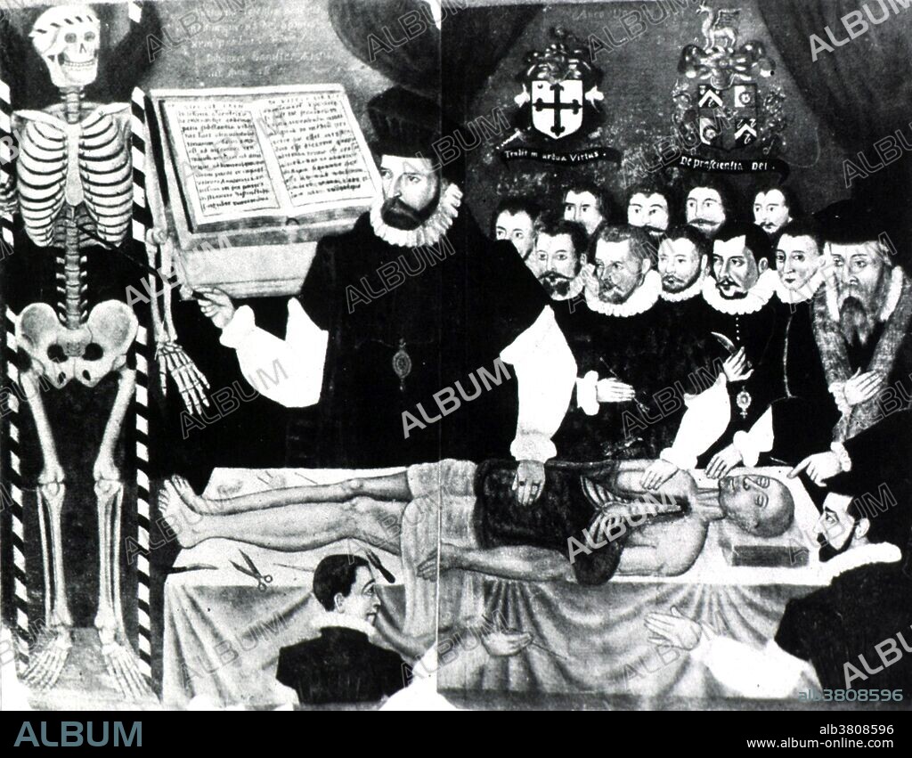 Entitled: "Dr. John Banister delivering the visceral lecture at the Barber-Surgeons' Hall in London, 1581." John Banister (1533-1610) was an English anatomist, surgeon and teacher. He published The Historie of Man, from the most approved Authorities in this Present Age in 1578. Human dissection is commonly practiced in the teaching of anatomy for students of medicine. No universal prohibition of dissection or autopsy was exercised during the Middle Ages. Rather, the era witnessed the revival of an interest in medical studies, and a renewal in human dissection and autopsy. Some European countries began legalizing the dissection of executed criminals for educational purposes in the late 13th and early 14th centuries, and Mondino de Liuzzi carried out the first recorded public dissection around 1315. Vesalius in the 16th century carried out numerous dissections in the process of performing some of the most extensive anatomical investigations up to his time, but was attacked frequently by other physicians for his disagreement with Galen's studies of human anatomy.