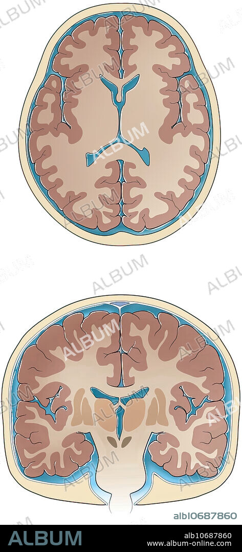 Normal coronal and cross-sections of brain, illustration. Slices through the normal brain and skull showing ventricles, white matter, grey matter, basal ganglia, thalamus sulci and gyri, cerebrospinal fluid and skull.