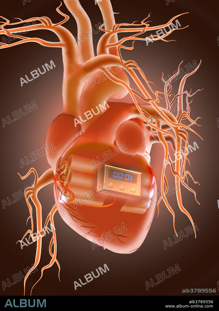 Conceptual image of a heart with a bomb inside.