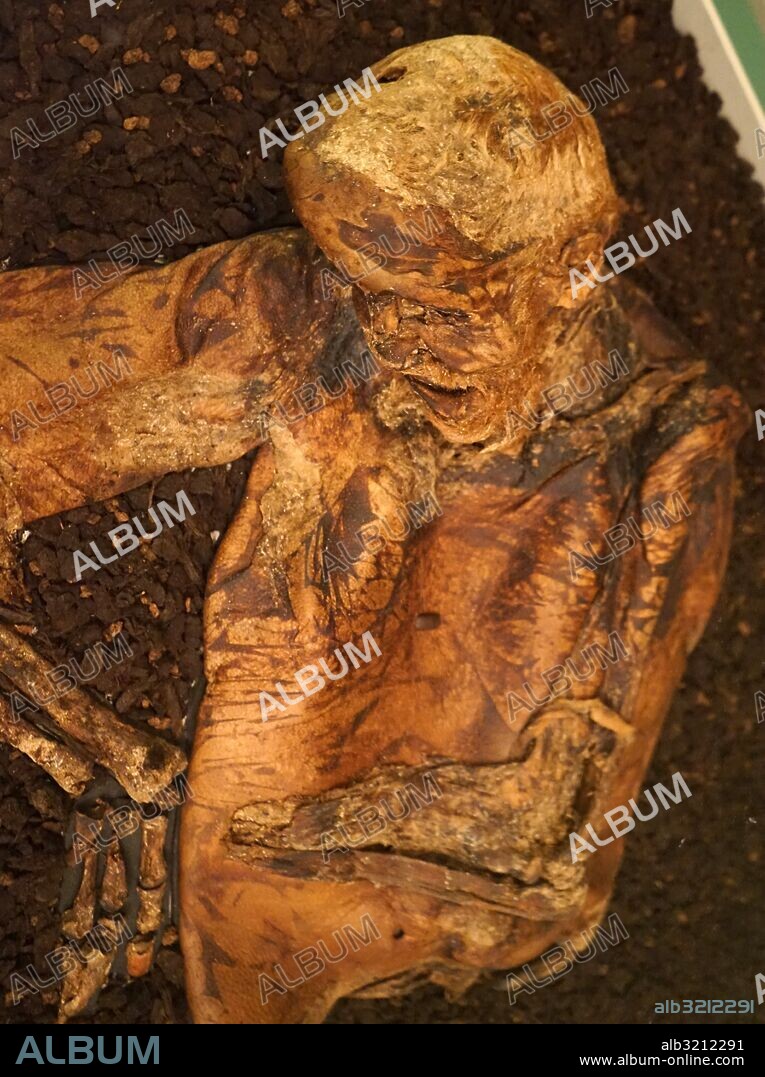 The Lindow Man is the preserved bog body of a man discovered in a peat bog at Lindow Moss near Wilmslow in Cheshire, North West England.