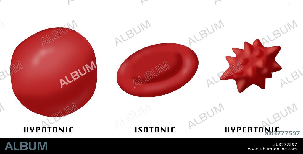 Illustration showing the effect of hypotonic, isotonic and hypertonic solutions on red blood cells.