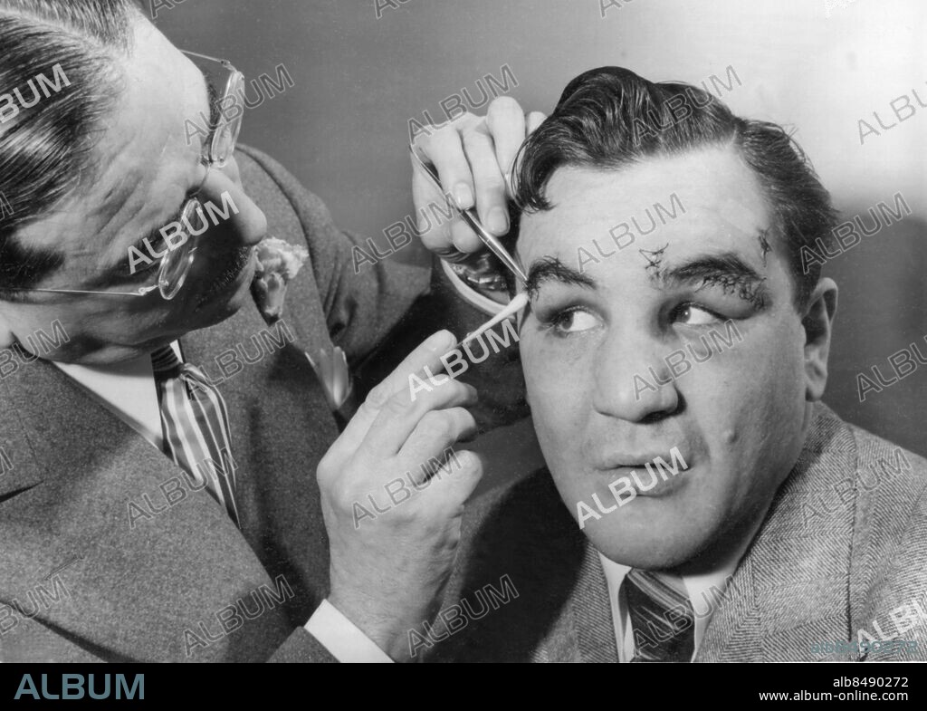 Orig. bildtext... MAURIELLO SHOWS SIGNS OF DEFEAT. New York. Doctor Vincent A. Nardiello, boxing commission physician, examines the eyes of Tami Mauriello of the Bronx, N.Y. who suffered a technical kayo from Johnny Shkor of Brighton, Mass., in the eight round of a scheduled 10-round bout at the Boston arena, friday night. The fight was stopped after the bell sounding the end of the seventh round when Dr Isaac Klein decided that Mauriellos eye was to badley cut for him to continue. Tami also had a cut on top of the head. To many it appeared that Shkor was doing considerable butting, using his head from the vantage point of greater height. Mauriellos manager claims he won six of the seven rounds before the fight was stopped. He's the leading heavyweight challenger. Anm. Plocka bort stygn Pincetter Bomullstops Skador Sytt ögonbryn Skador Sårad CD183 persons: VINCENT NARDIELLO;TAMI MAURIELLO sites: NEW YORK;USA.