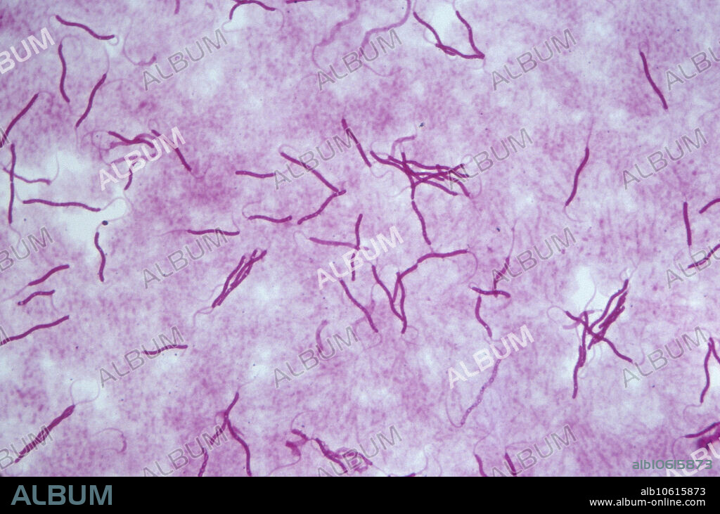 Spirillum volutans is a gram-negative, flagellated spirochete. The bacterium is found in freshwater.  Magnification: 140x.