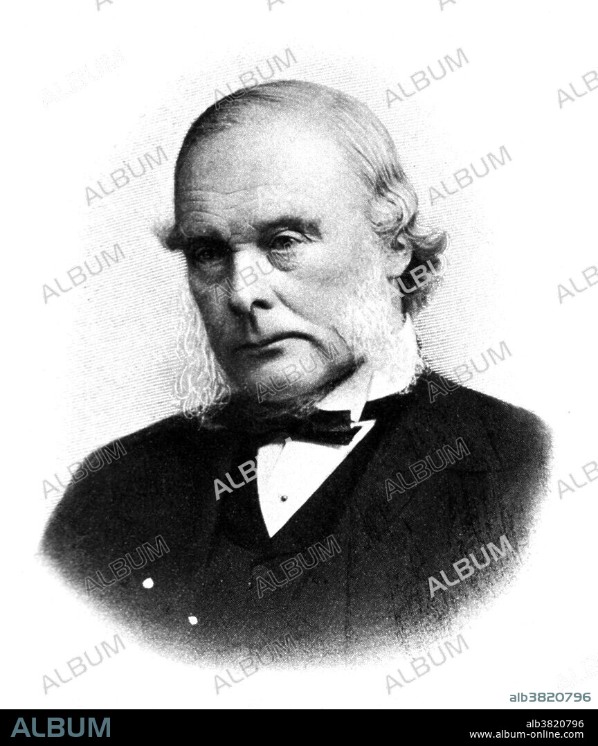 Joseph Lister (April 5,1827 - February 10, 1912) was an English surgeon and a pioneer of antiseptic surgery. Until Lister's studies of surgery most people believed that chemical damage from exposures to bad air (miasma) was responsible for infections in wounds. He found that carbolic acid solution swabbed on wounds remarkably reduced the incidence of gangrene. Lister tested the results of spraying instruments, the surgical incisions, and dressings with a solution of it. He instructed surgeons under his responsibility to wear clean gloves and wash their hands before and after operations with 5% carbolic acid solutions. Instruments were also washed in the same solution and assistants sprayed the solution in the operating theater. As the germ theory of disease became more widely accepted, it was realized that infection could be better avoided by preventing bacteria from getting into wounds in the first place. Lister died in 1912 at the age of 84.