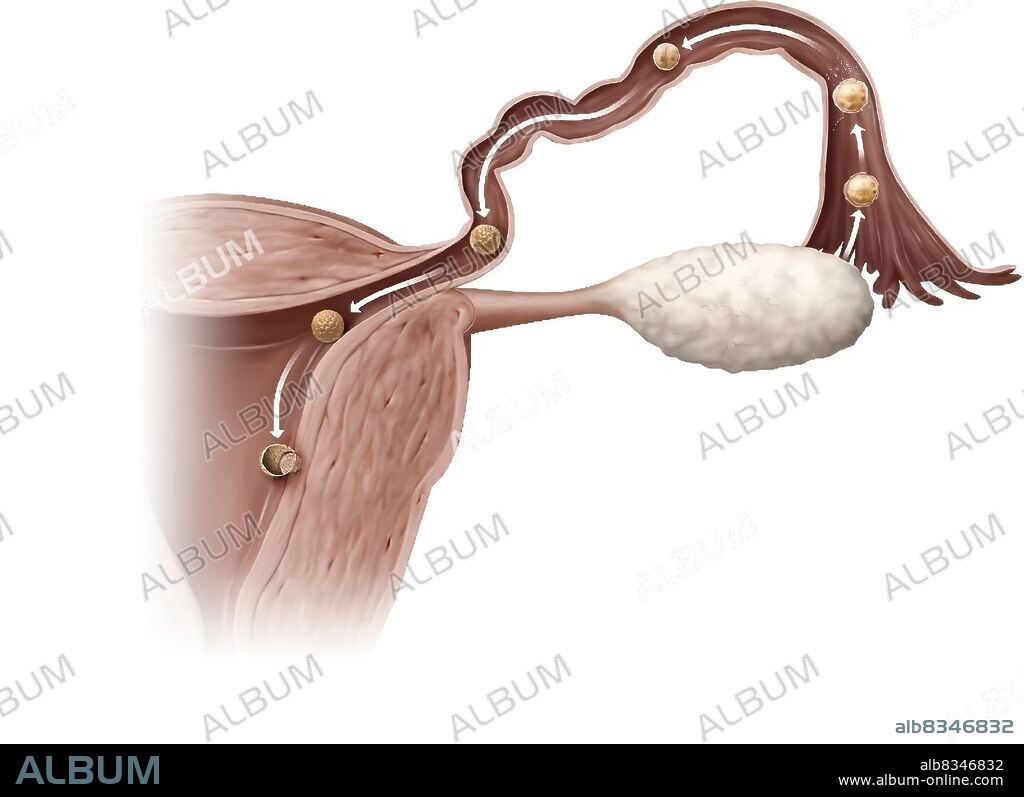 Nidation is the implantation of a fertilized egg in the endometrium, six or seven days after fertilization. The cells of its outer layer (trophoblast) multiply and erode the endometrium, which enables the blastocyst to anchor itself there. The implantation phase lasts approximately one week.