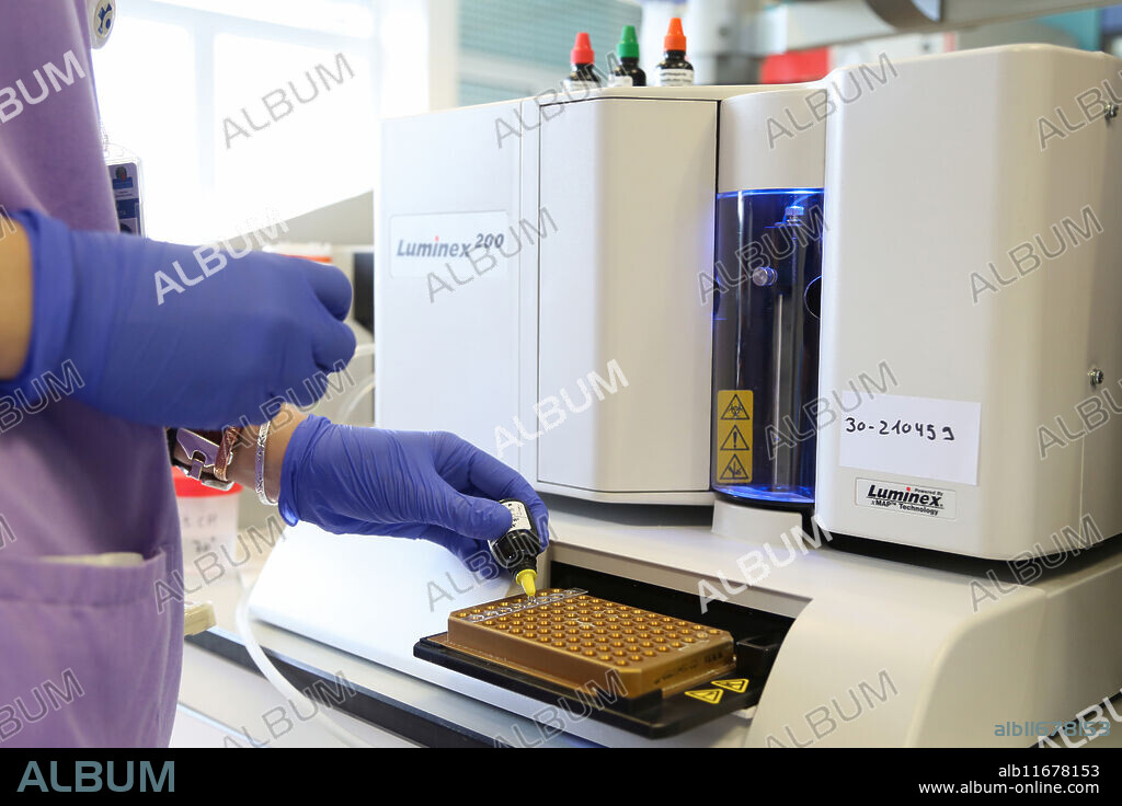 PCR, Luminex, Microbiology Department, Donostia Hospital, San Sebastian, Donostia, Gipuzkoa, Basque Country, Spain.