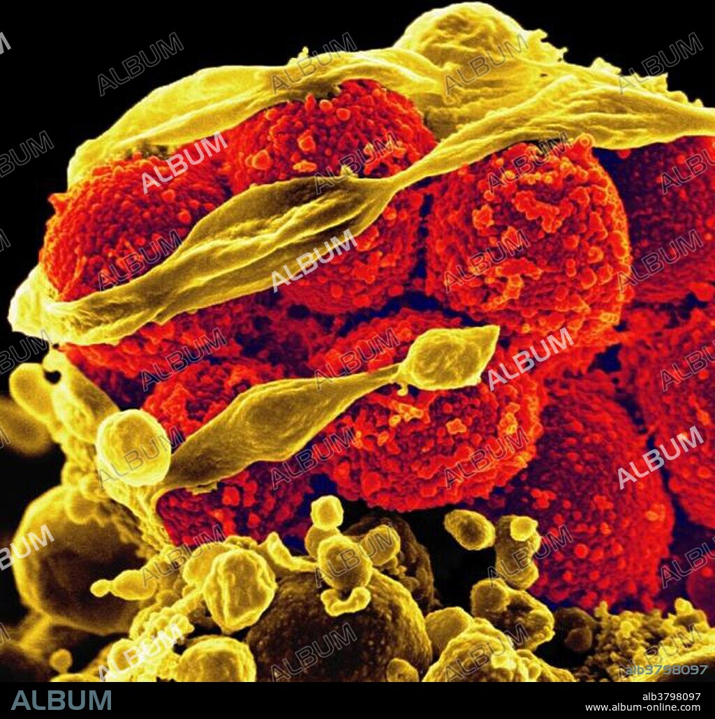 Scanning electron micrograph of methicillin-resistant Staphylococcus aureus bacteria (yellow, round items) killing and escaping from a human white cell. Methicillin-resistant Staphylococcus aureus (MRSA) is a bacterium responsible for several difficult-to-treat infections in humans. It is also called multidrug-resistant Staphylococcus aureus and oxacillin-resistant Staphylococcus aureus (ORSA). MRSA is any strain of Staphylococcus aureus that has developed resistance to beta-lactam antibiotics, which include penicillins and cephalosporins. Strains unable to resist these antibiotics are classified as methicillin-sensitive Staphylococcus aureus, or MSSA. The development of such resistance does not cause the organism to be more intrinsically virulent than strains of Staphylococcus aureus that have no antibiotic resistance, but resistance does make MRSA infection more difficult to treat with standard types of antibiotics and thus more dangerous. MRSA is especially troublesome in hospitals and nursing homes, where patients with open wounds, invasive devices, and weakened immune systems are at greater risk of infection than the general public.