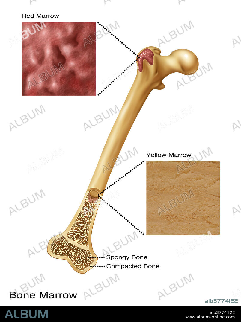 Illustration of bone marrow. Top diagram shows red bone marrow, Bottom diagram shows yellow marrow. Spongy bone and compacted bone also visible.