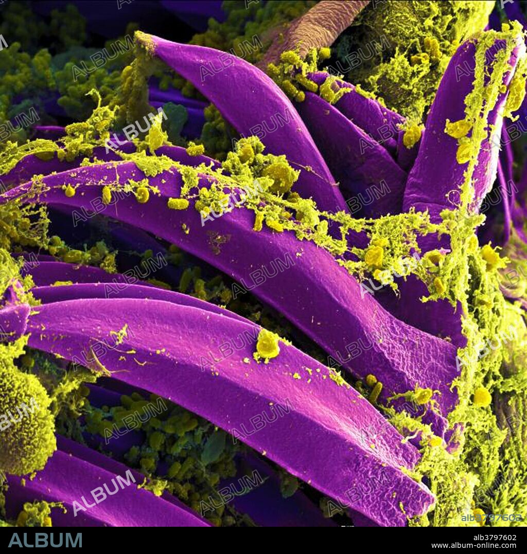 Scanning electron micrograph of Yersinia pestis bacteria on proventricular spines of a Xenopsylla cheopis flea. Yersinia pestis (formerly Pasteurella pestis) is a Gram-negative rod-shaped bacterium. It is a facultative anaerobe that can infect humans and other animals. Human Yersinia pestis infection takes three main forms: pneumonic, septicemic, and the notorious bubonic plagues. All three forms are widely believed to have been responsible for a number of high-mortality epidemics throughout human history, including the Plague of Justinian in 542 and the Black Death that accounted for the death of at least one-third of the European population between 1347 and 1353. More recently, Yersinia pestis has gained attention as a possible biological warfare agent and the CDC has classified it as a category A pathogen requiring preparation for a possible terrorist attack.