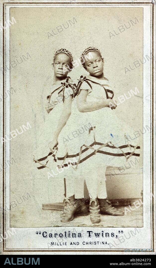 Entitled: "Carolina twins, Millie and Christina." Millie McCoy and Christine McCoy (July 11, 1851 - October 8, 1912) were American conjoined twins (medically classified as pygopagus twins). They were born into slavery in North Carolina in 1851. They were sold to a showman, J.P. Smith, at birth, but were soon kidnapped by a rival showman. The kidnapper fled to England but was thwarted because England had already banned slavery. Smith traveled to England to collect the girls and brought with him their mother, Monimia, from whom they had been separated. He and his wife provided the twins with an education and taught them to speak five languages, play music, and sing. For the rest of the century the twins enjoyed a successful career as "The Two-Headed Nightingale" and appeared with the Barnum Circus. They died of tuberculosis, in 1912, at the age of 61, 17 hours apart. Photographed by Joseph Pearson Smith, 1866.