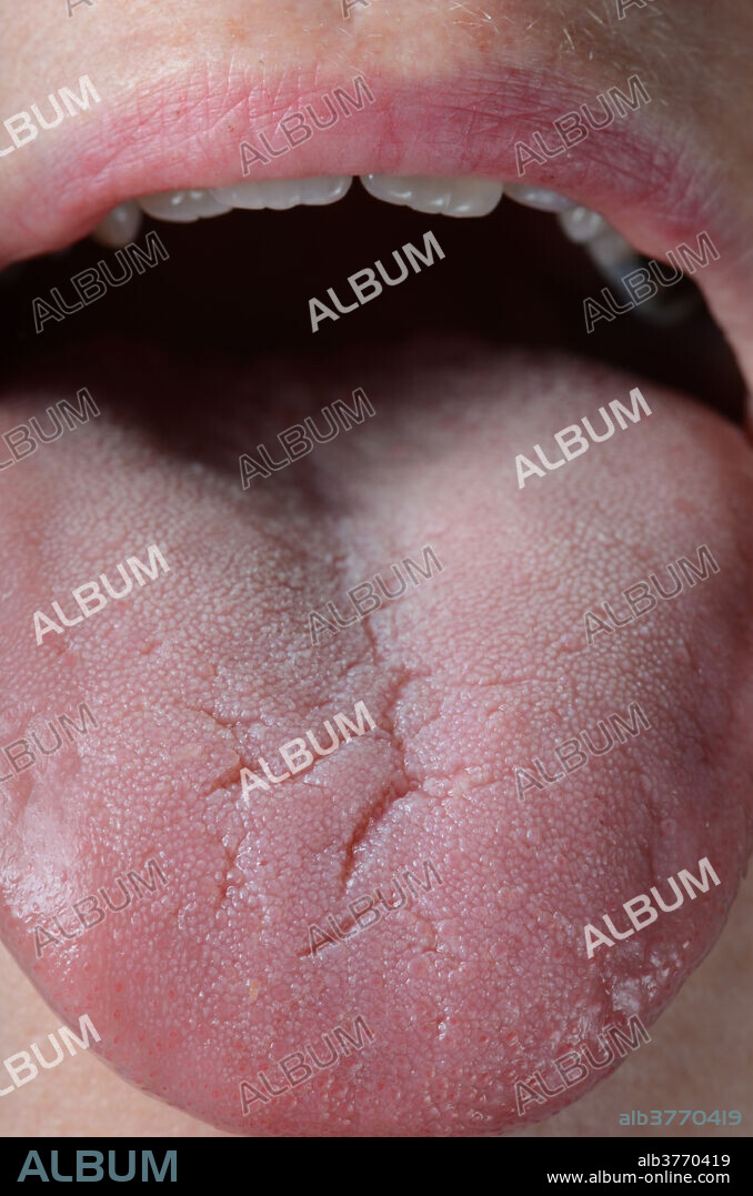 Close-up of tongue showing taste buds.