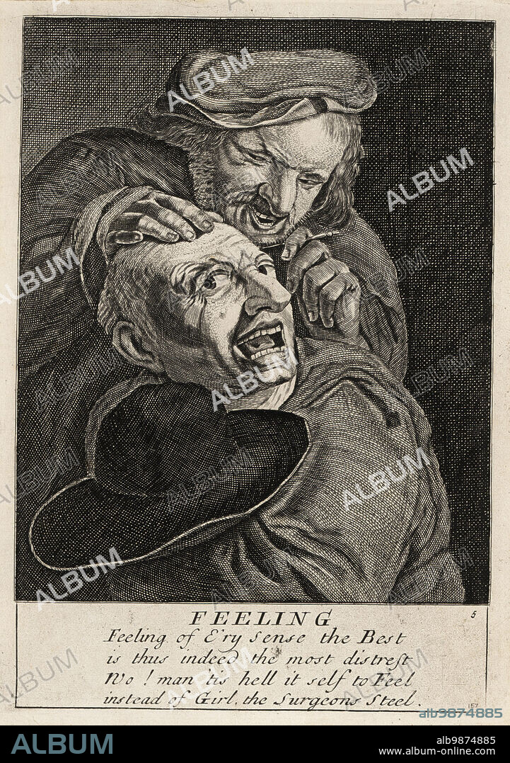 17th century English barber-surgeon operating on a man's head with a lancet. Feeling. Feeling of e'ry sense the best is thus indeed the most distrest. No! man 'tis hell it self to feel instead of girl, the surgeons steel. Possibly from an original print in The merry conceited five senses, Robert Walton, 1661. Copperplate engraving by David Deuchar from A Collection of Etchings after the most Eminent Masters of the Dutch and Flemish Schools, Edinburgh, 1803.