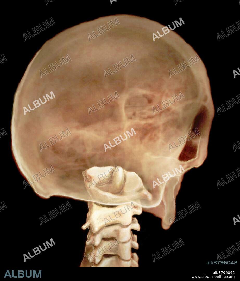 Three-dimensional visualisation based on segmented human data of the atlas and axis, the first two cervical vertebrae which form a pivot joint that allows the head to move from side to side. A unique part of the axis is the dens. The dens is a rounded, upward pointing projection which protrudes into the atlas bone to allow unilateral rotation from side to side.