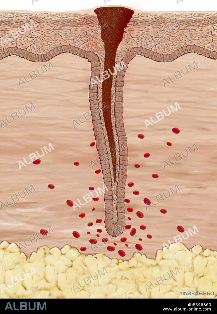 The blood clot turns into a scab, which protects the injured tissues from infection and prevents their dehydration.