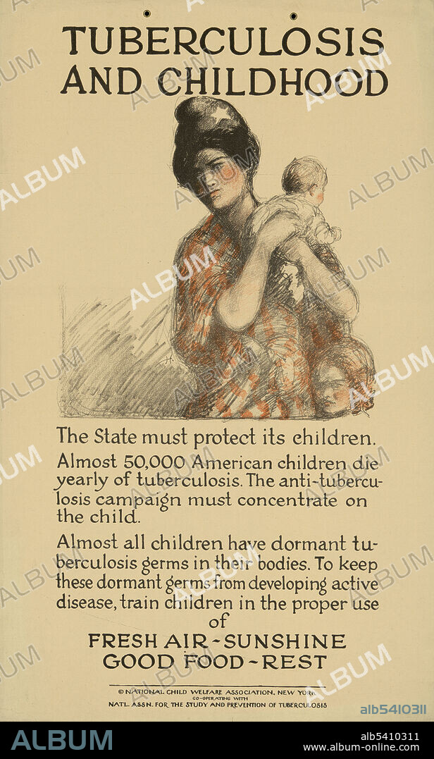 An informational poster put out by the National Child Welfare Association with the National Association for the Study and Prevention of Tuberculosis, c. 1920-1923.
