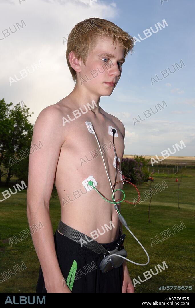 14-year-old boy wearing holter monitor.