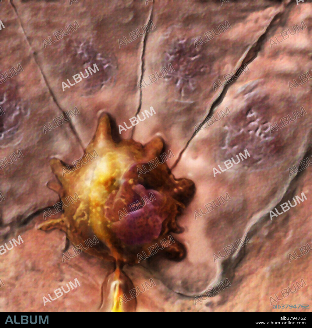 Merkel disc. Most commonly found in the basal layer of the epidermis, this slowly adapting receptor senses light pressure from the skins surface.