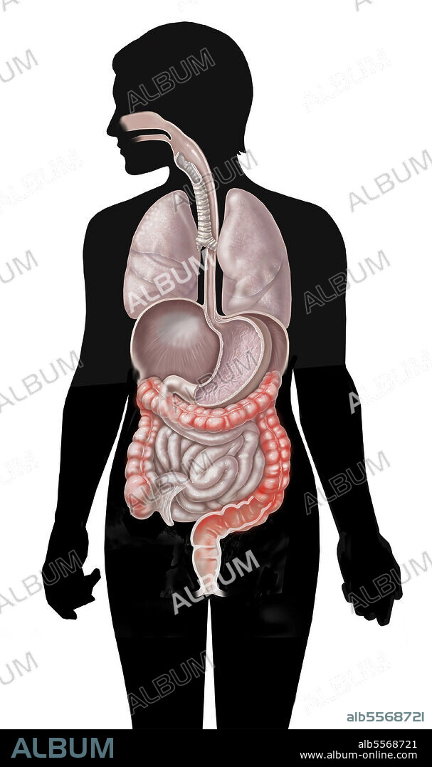 Location of ulcerative colitis in large intestine on female silhouette.