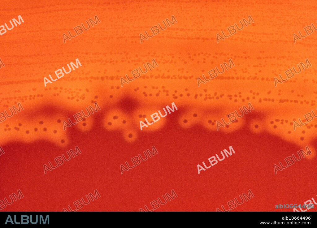 Streptococcus pyogenes ( strep throat bacteria). Beta hemolysis on sheep blood agar plate.