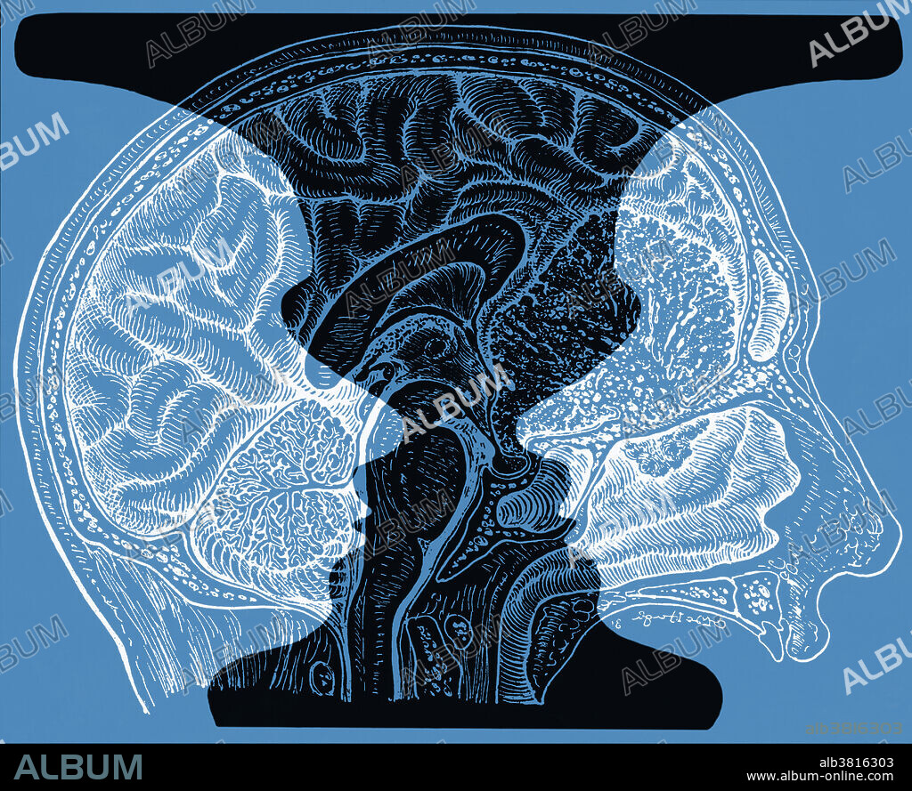 Conceptual illustration of a brain superimposed on the optical illusion of a Rubin vase. The Rubin vase is a famous set of ambiguous or bi-stable (i.e., reversing) two-dimensional forms developed around 1915 by the Danish psychologist Edgar Rubin. A viewer sees the image either as two faces looking at each other in front of a black background, or as a black vase. The shape of the image depends on the side of the line a viewer chooses as part of the figure. This is important because the human brain has in general just one object in the field of perception and the other objects go into the background.