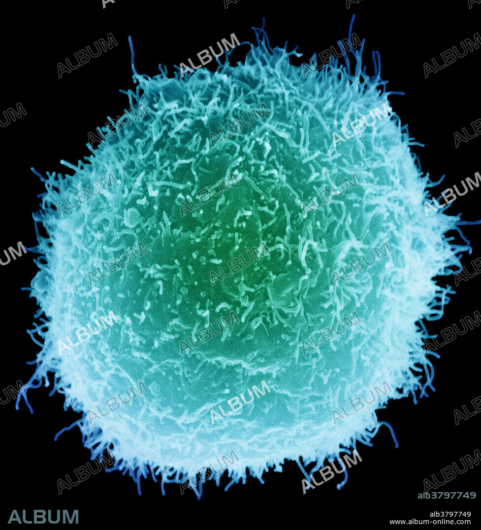 colour enhanced scanning electron micrograph (SEM) of macrophages with projectile-looking surfaces interacting with lymphocytes (rounded). Macrophages are monocytes (white blood cells) that have left the blood and become phagocytic cells. The act as part of the immune system, engulfing foreign material and dying cells in the body. Lymphocytes are white blood cells that function as a part of the immune system. There are different types of lymphocytes, each with a different task. They make antibodies, kill viruses, enhance the production of antibodies, or bring macrophages and neutrophils to sites of infection or tissue damage (inflammatory T cells).