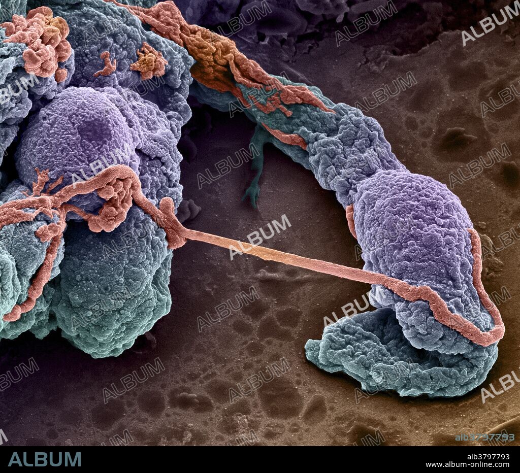 Scanning electron micrograph of capillaries or microvessels (blue/orange/purple 3D cylindrical structures) isolated from a mouse brain. Brain microvessels are characterized by the presence of neurovascular units, the building blocks of the blood brain barrier (a protective layer of cells that regulates entry of molecules to the brain). The neurovascular unit is made up of endothelial cells surrounded by other cell types which regulate the exchange of molecules between the blood and the brain. This together with the thin diameter of the capillary makes it difficult for circulating drugs to reach the brain. New approaches to brain drug delivery will be key to tackle many neurological disorders. Diameter of each blood vessel is approximately 5 micrometres. Supplied by Izzat Suffian, Houmam Kafa, David McCarthy & Khuloud T. Al-Jamal, courtesy of Wellcome Images.
