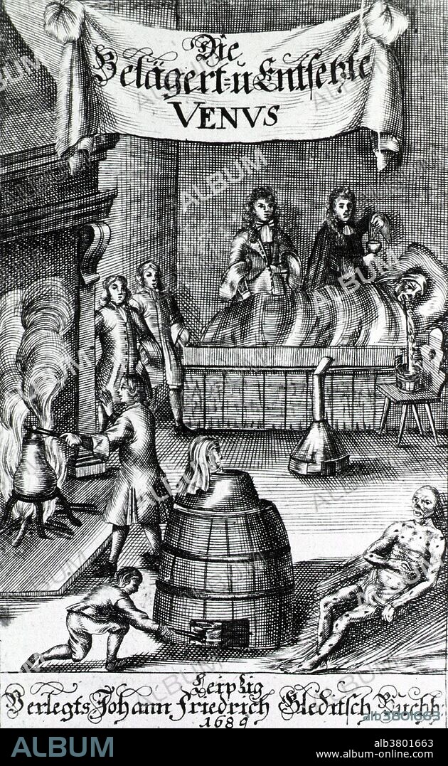 Interior scene showing people involved in various methods of syphilis treatment, including mercury fumigation. At lower right is a man in the final stages of the disease, with syphilitic skin pustules on his whole body and no nose. At lower center a patient is in a steam bath or sauna. At left and upper center, physicians are preparing medications for the patient in the bed at upper right; at this time, medications for syphilis contained mercury, a poisonous metal. The banner at top center refers to Venus, the goddess of love. Syphilis is caused by infection by the Treponema pallidum bacterium. Image from Leipzig, Germany, 1689.
