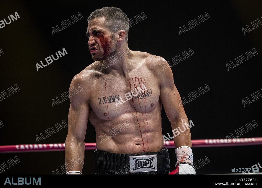 BLACK EYE and JAKE GYLLENHAAL. JAKE GYLLENHAAL in SOUTHPAW, 2015, directed by ANTOINE FUQUA. Copyright ESCAPE ARTISTS.